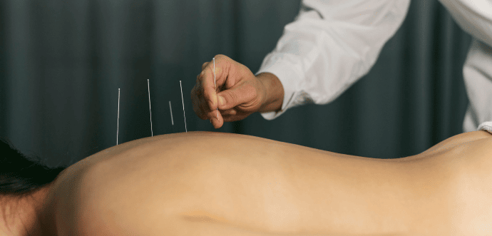 Anesthesiology acupuncture
